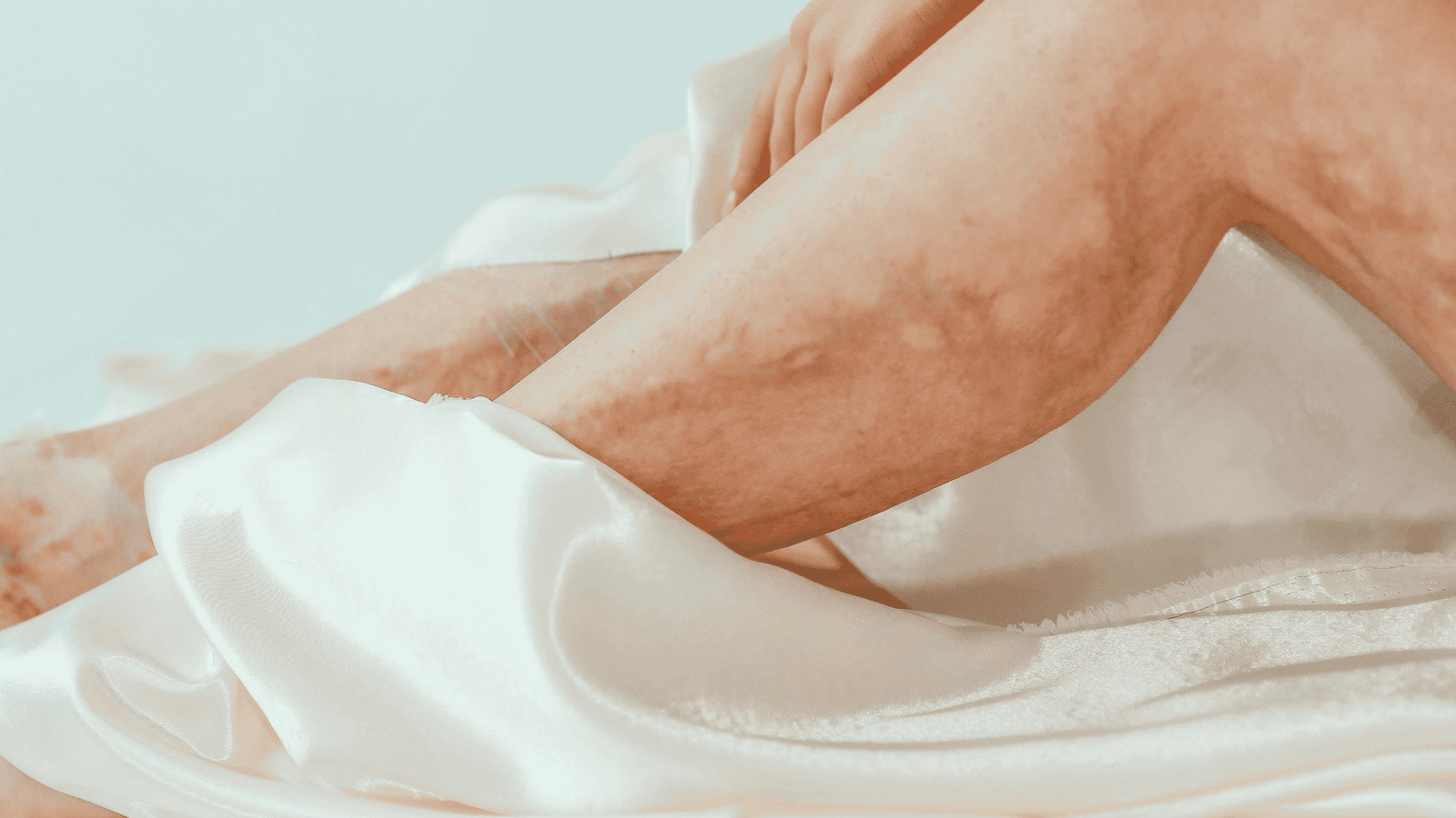 IVC | Dr. Antonio Queiroz | Cirurgião Vascular