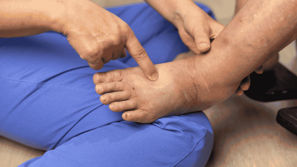 Resgate do Pé Diabético | Dr. Antonio Queiroz | Cirurgião Cardiovascular