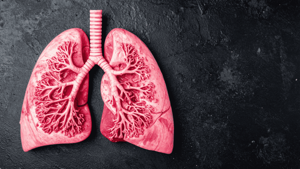 Tromboembolismo Pulmonar (TEP) | Dr. Cirurgião Vascular | Cirurgião Vascular