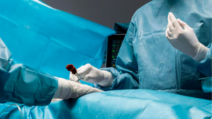 Cirurgia Vascular Minimamente Invasiva | Dr. Antonio Queiroz | Cirurgião Vascular