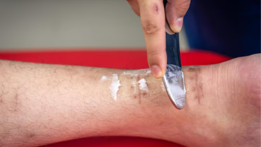 Úlceras varicosas | Dr. Antônio Queiroz