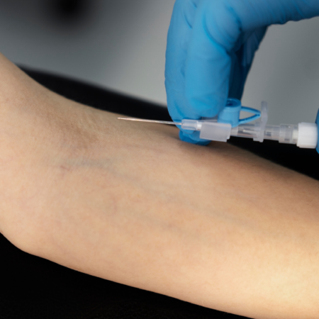 Angiografia por Cateter: 6 Indicações e Como o Exame Salva Vidas Vasculares | Dr. Antônio Queiroz