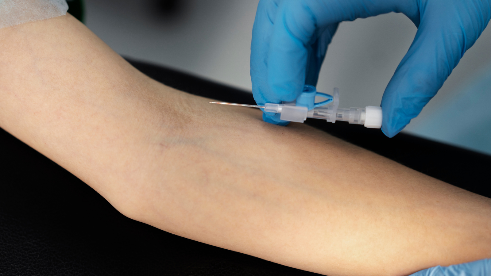 Angiografia por Cateter: 6 Indicações e Como o Exame Salva Vidas Vasculares | Dr. Antônio Queiroz