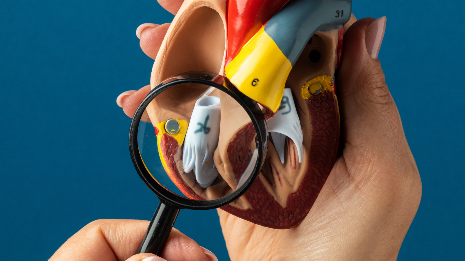 Hipercolesterolemia Familiar: 5 Sinais, Diagnóstico e o Papel do Angiologista | Dr. Antônio Queiroz