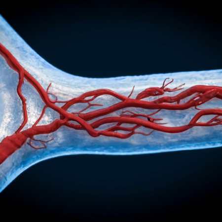 Livedo Reticular: 7 Causas, Sintomas e Diagnóstico Vascular | Dr. Antônio Queiroz