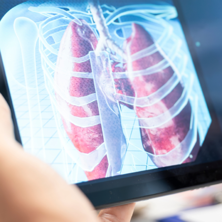 Angiotomografia Vascular: 6 Indicações e Como o Exame Orienta o Cirurgião Vascular | Dr. Antônio Queiroz