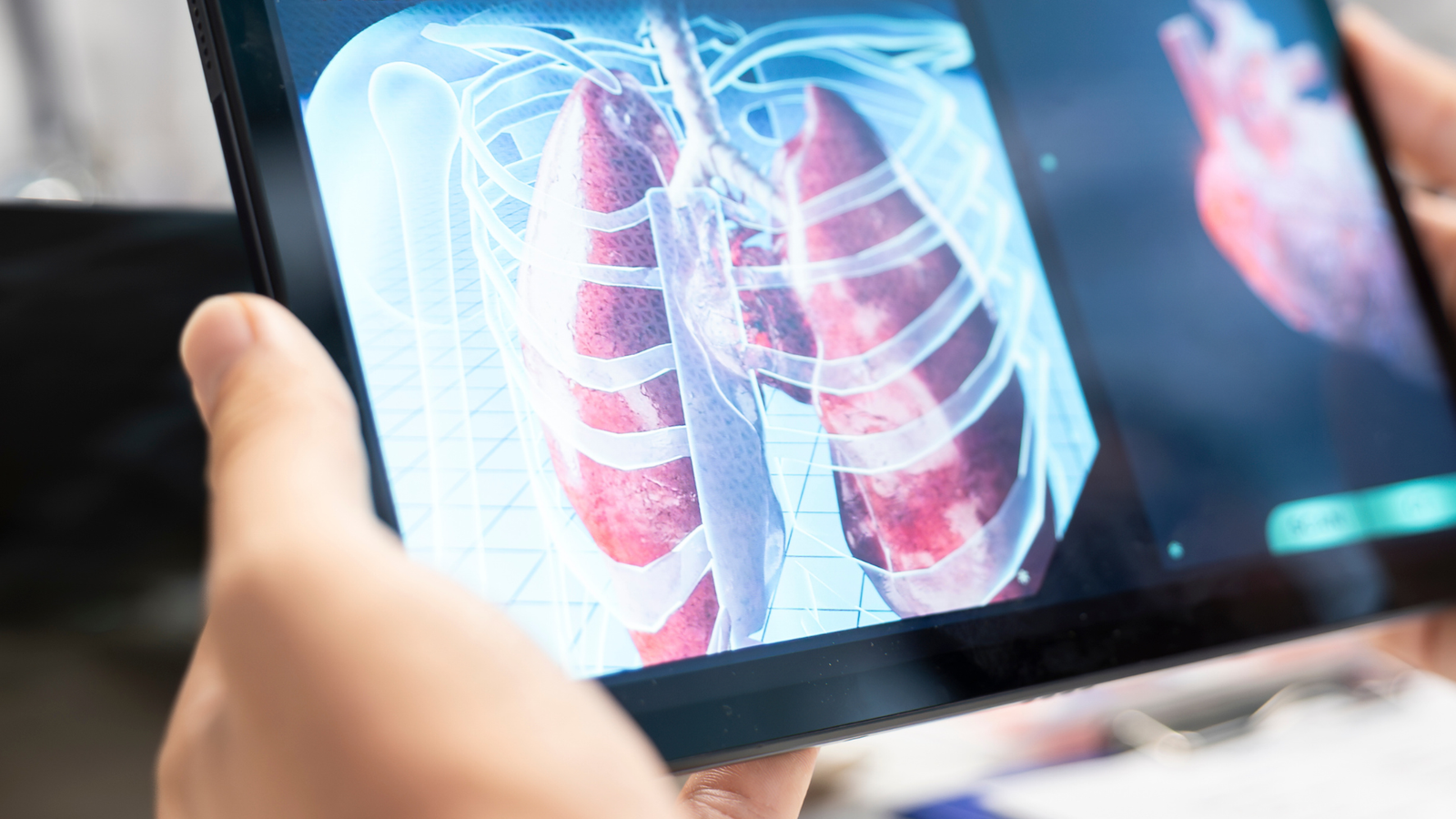 Angiotomografia Vascular: 6 Indicações e Como o Exame Orienta o Cirurgião Vascular | Dr. Antônio Queiroz